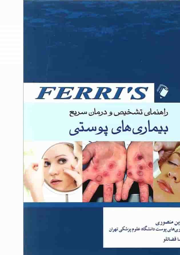 راهنمای تشخیص و درمان بیماری های پوستی فری اندیشه رفیع راهنمای تشخیص و درمان بیماری های پوستی فری اندیشه رفیع
